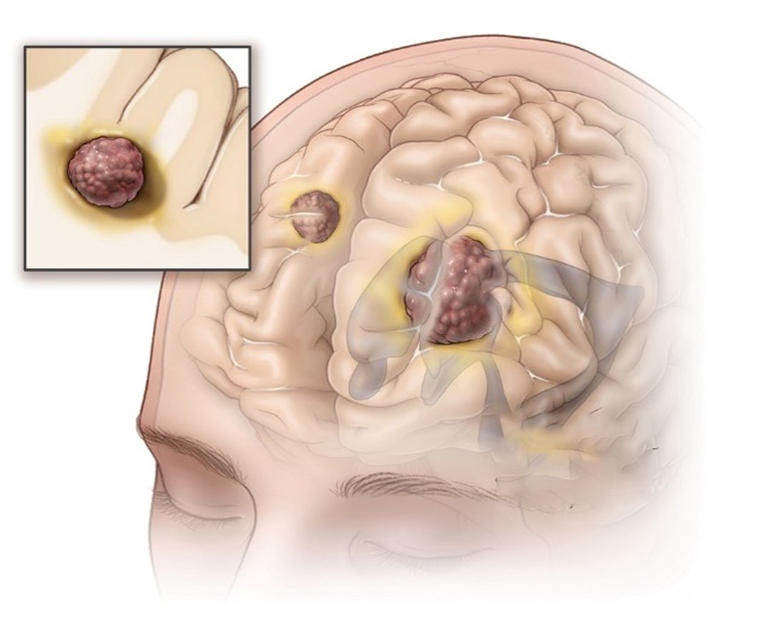 Healthcare consultation