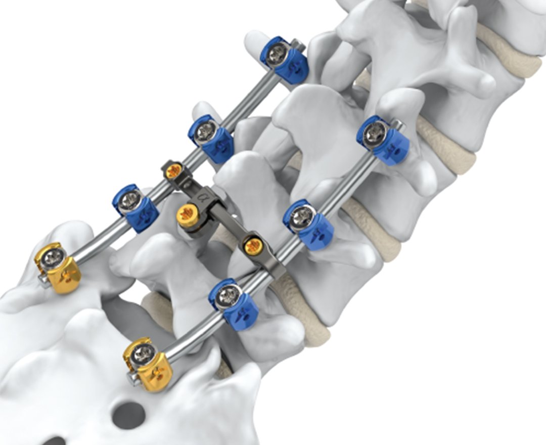 Healthcare consultation