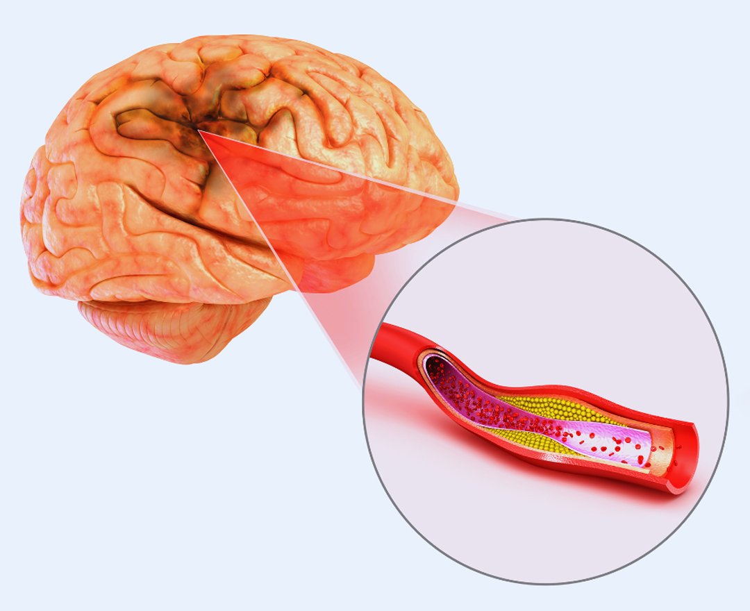 Healthcare consultation