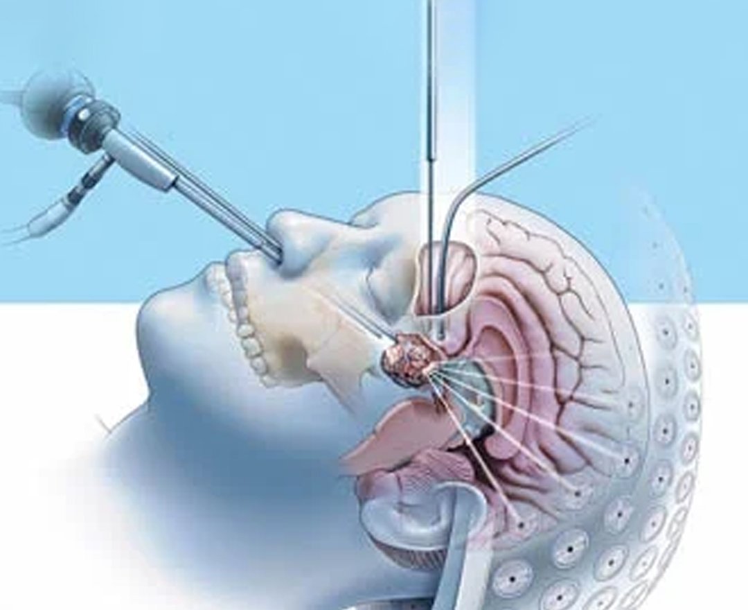 Healthcare consultation